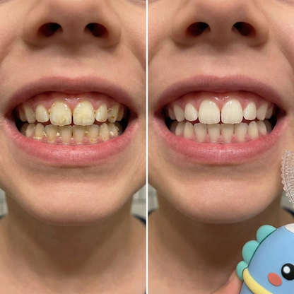 KLENIMORE™ Kids 360 Self Brush